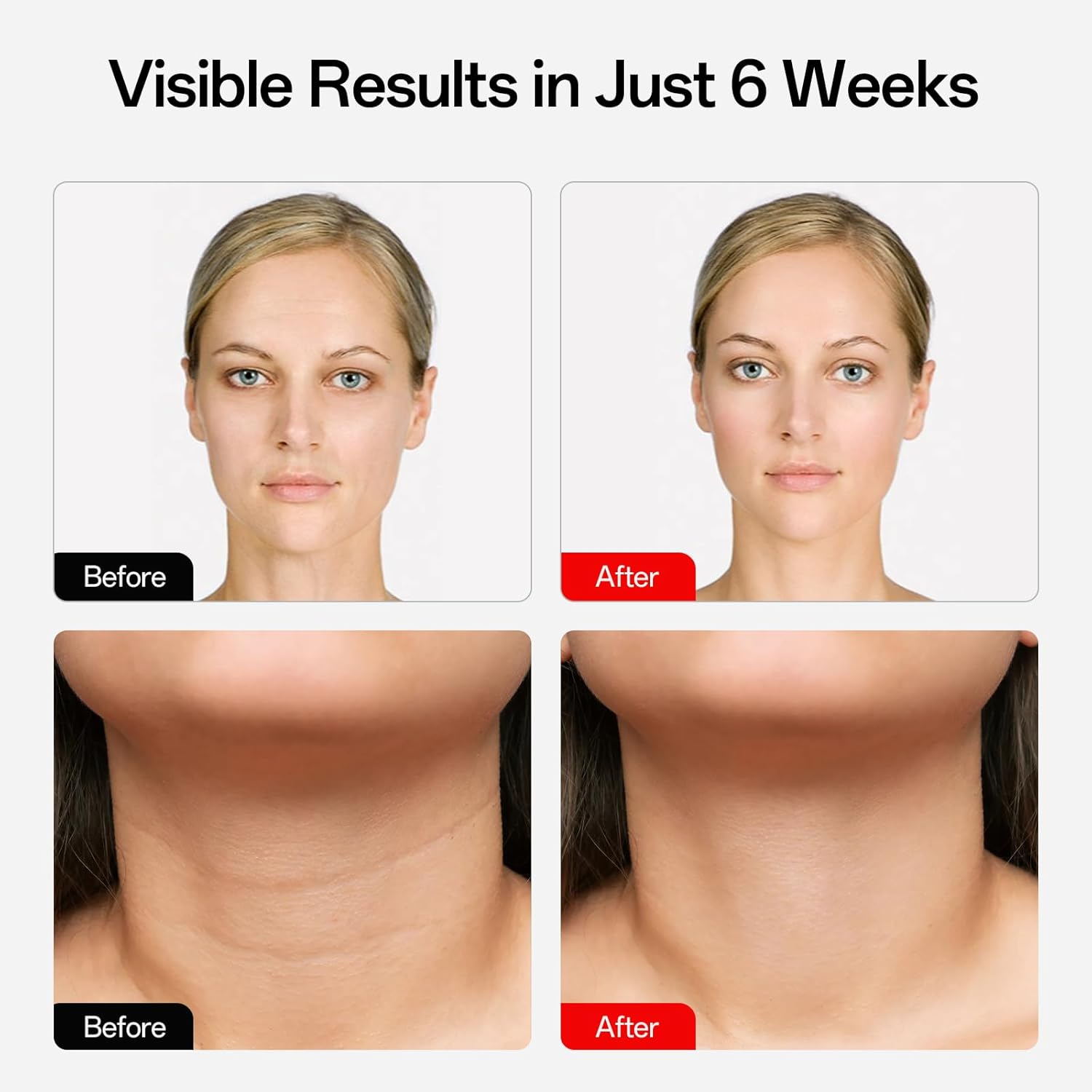 Light Therapy Facial-X7 (SEVEN Light Treatments in ONE)